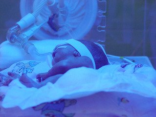 Koraszülés világnapi Ünnep a Megyei Kórházban