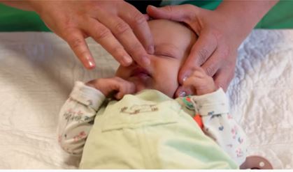 Semmelweis Egyetem: A könnycsatorna-elzáródás már újszülöttkorban gyógyítható