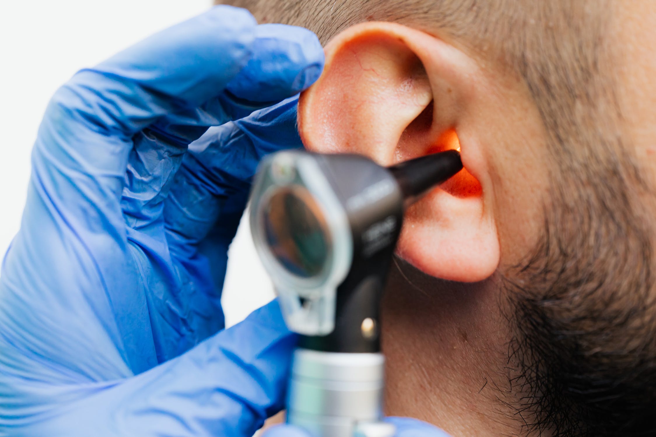 Füles kérdések – a füldugulással javasolt orvoshoz fordulni