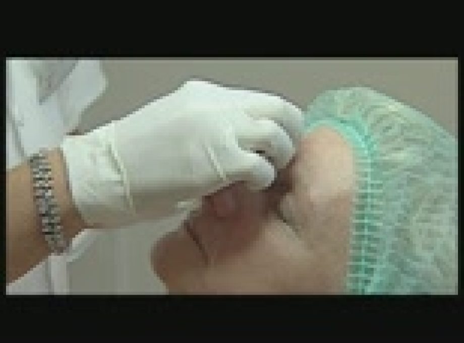 6671-mi-a-botox