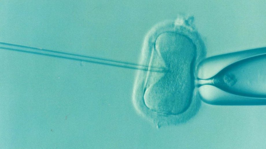ivf-1514174_1280